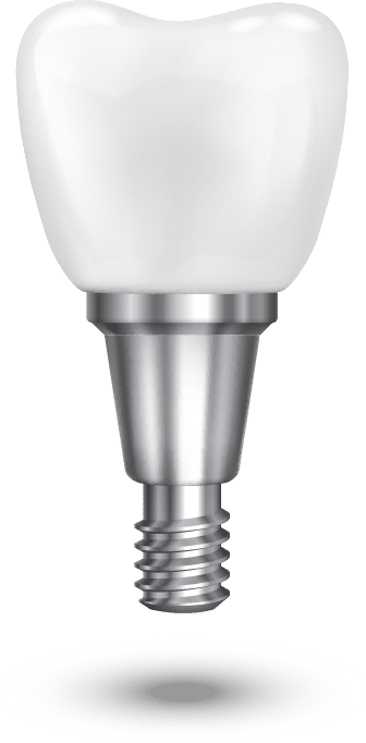 what is a dental implant bristol what is a dental implant bristol