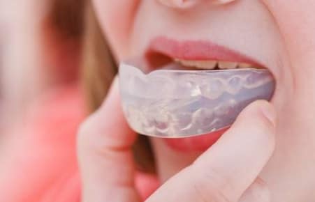 Children’s Mouthguard or Gumshield